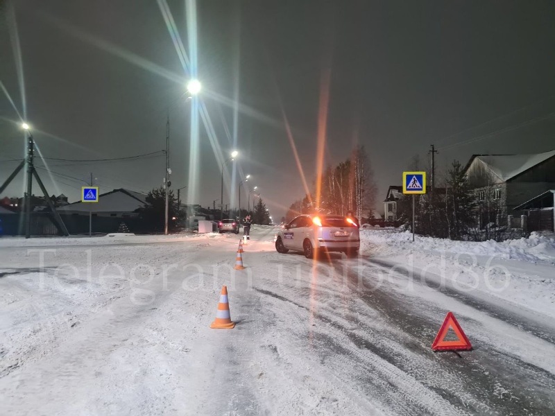 В Югре пострадал несовершеннолетний пешеход.