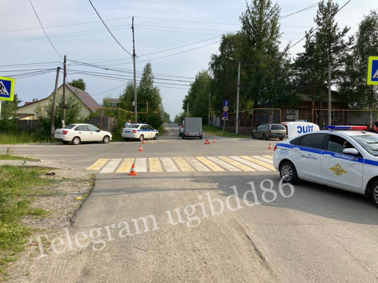 В Югре по собственной неосторожности пострадал юный велосипедист. В Югре по собственной неосторожности пострадал юный велосипедист.