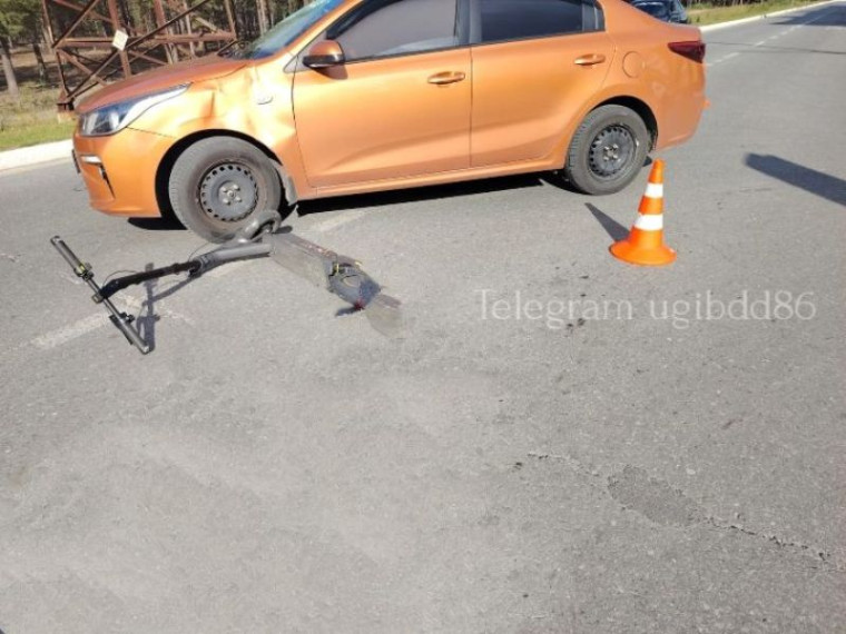 В Нижневартовском районе в результате ДТП пострадал нетрезвый водитель электросамоката. В Нижневартовском районе в результате ДТП пострадал нетрезвый водитель электросамоката.